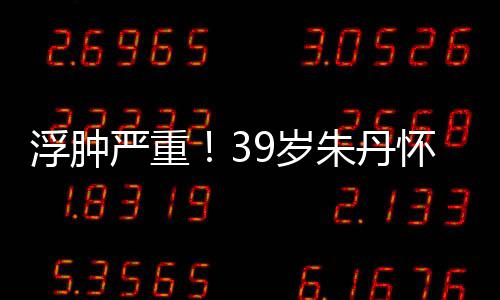 7个带货朱丹直播怀孕严重月 坚持浮肿9岁深夜